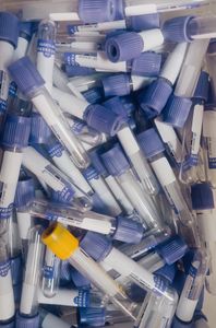 Blood Tests for Vegetarians: Close-up of assorted blue and yellow cap laboratory test tubes, ideal for medical stock photos.